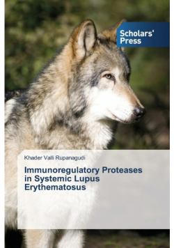 Immunoregulatory Proteases in Systemic Lupus Erythematosus