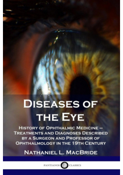 Diseases of the Eye
