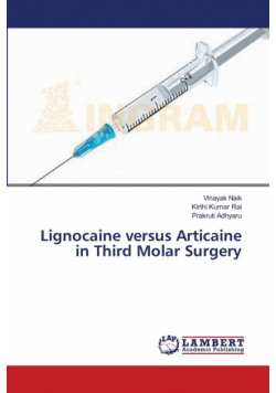 Lignocaine versus Articaine in Third Molar Surgery