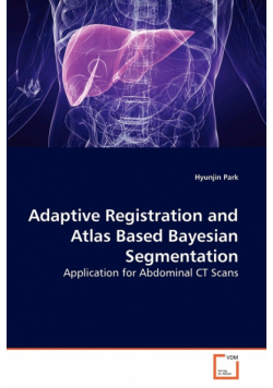 Adaptive Registration and Atlas Based Bayesian Segmentation