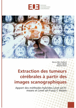 Extraction des tumeurs cérébrales à partir des images scanographiques