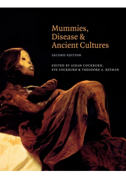 Mummies, Disease and Ancient Cultures