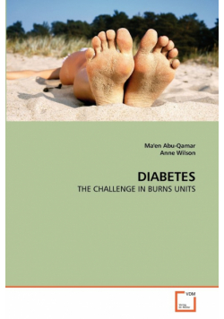 Diabetes