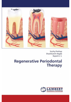Regenerative Periodontal Therapy
