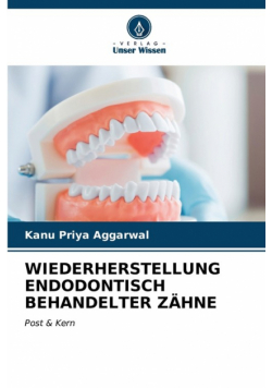 Wiederherstellung Endodontisch Behandelter Zähne