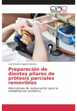 Preparación de dientes pilares de prótesis parciales removibles