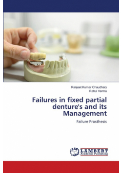Failures in fixed partial denture's and its Management