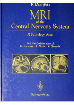 MRI of the Central Nervous System a pathology atlas