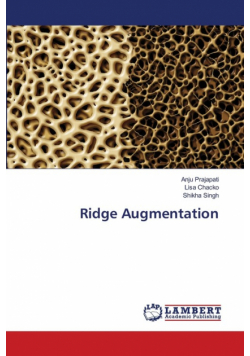 Ridge Augmentation