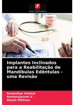 Implantes Inclinados para a Reabilitação de Mandíbulas Edêntulas - uma Revisão