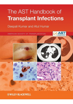 AST Handbook of Transplant Inf