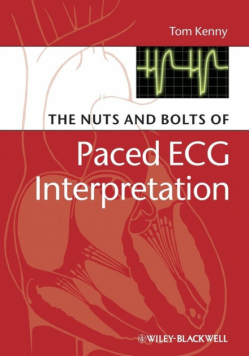 The Nuts and Bolts of Paced ECG Interpretation