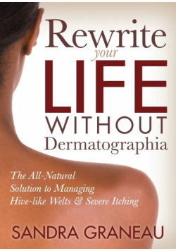 Rewrite Your Life Without Dermatographia