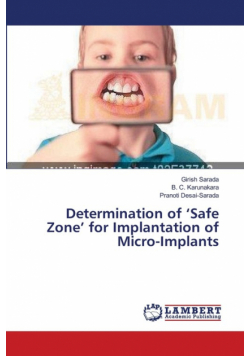 Determination of 'Safe Zone' for Implantation of Micro-Implants