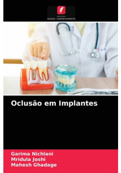 Oclusão em Implantes