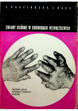 Zmiany skórne w chorobach wewnętrznych