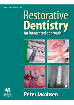 Restorative Dentistry 2e