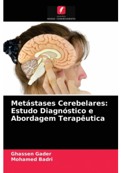 Metástases Cerebelares