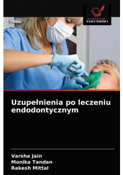 Uzupełnienia po leczeniu endodontycznym