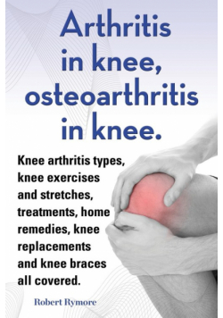 Arthritis in knee, osteoarthritis in knee. Knee arthritis types, knee exercises and stretches, treatments, home remedies, knee replacements and knee braces all covered.
