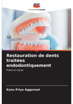 Restauration de dents traitées endodontiquement