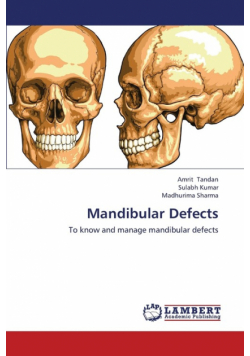 Mandibular Defects