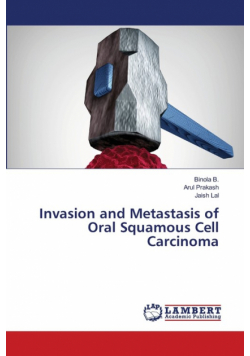 Invasion and Metastasis of Oral Squamous Cell Carcinoma