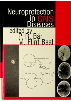 Neuroprotection in CNS Diseases