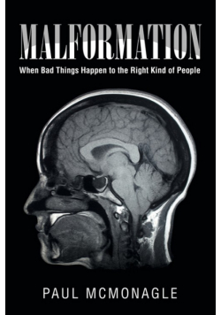 Malformation