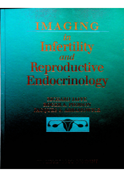 Imaging in infertility and reproductive endoctinology