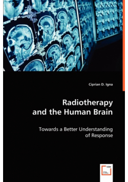 Radiotherapy and the Human Brain