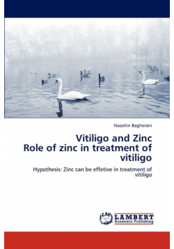 Vitiligo and Zinc  Role of zinc in treatment of vitiligo