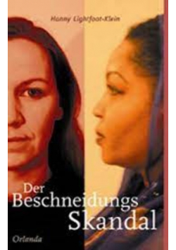 Der Beschneidungsskandal