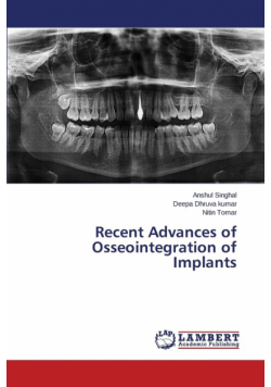 Recent Advances of Osseointegration of Implants