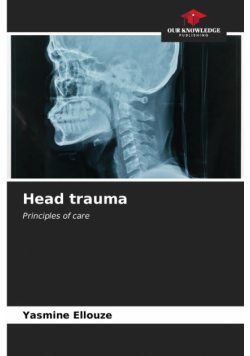 Head trauma