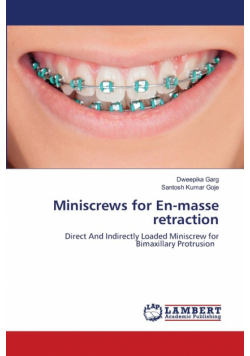 Miniscrews for En-masse retraction