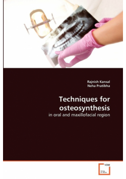 Techniques for osteosynthesis