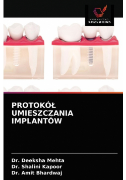 Protokół Umieszczania Implantów