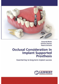 Occlusal Consideration In Implant Supported Prosthesis