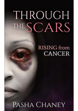 Through the Scars