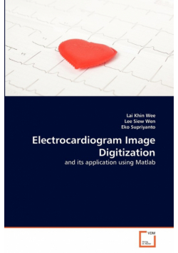 Electrocardiogram Image Digitization