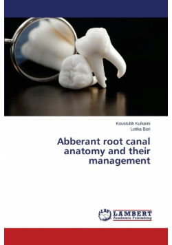 Abberant Root Canal Anatomy and Their Management