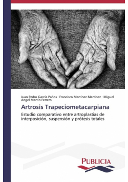 Artrosis Trapeciometacarpiana