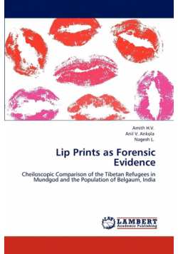Lip Prints as Forensic Evidence