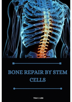 Bone repair by stem cells