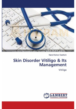Skin Disorder Vitiligo & Its Management