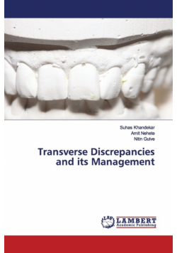 Transverse Discrepancies and its Management