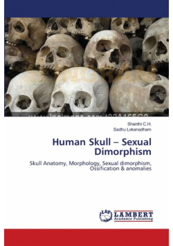 Human Skull - Sexual Dimorphism