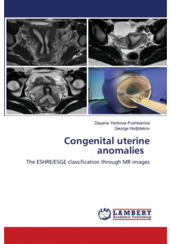 Congenital uterine anomalies