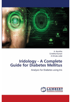 Iridology - A Complete Guide for Diabetes Mellitus